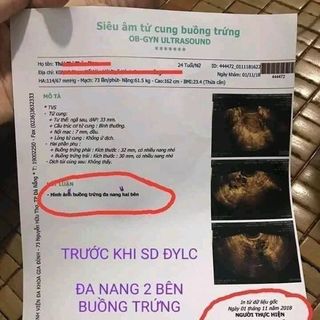Viên Uống Thảo Mộc Tái Xuân Lan Chi