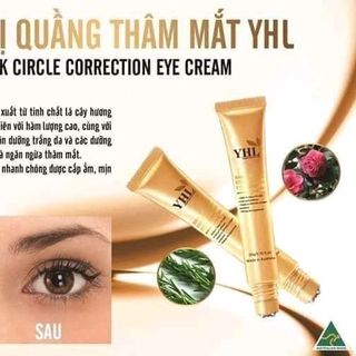 KEM TRỊ THÂM QUẦNG MẮT YHL