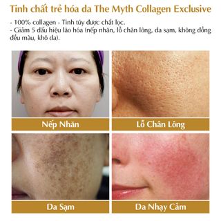 The Myth - Collagen Exclusive Giảm Nếp Nhăn