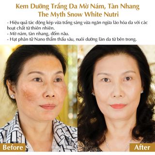 The Myth - Snow White Nutri Dưỡng Trắng Da