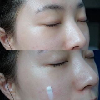 Kem trị thâm Dermasby Caviar Madecassoside Cream