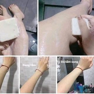 xà phòng trị mụn thái lan