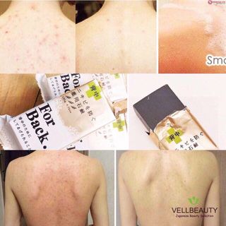 Xà phòng trị mụn lưng của nhật