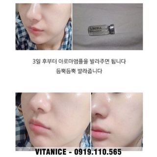 Thay da - peel da sinh học QSCELL