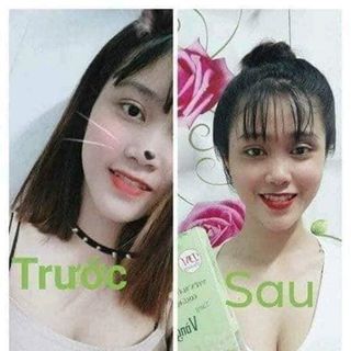 Mầm Đậu Nành Tăng V1 collagen DM 

Chị em nào Ngực Lép Ngực Xệ Ngực Thiếu Sữa thì hãy chọn ngay cho mình 1 liệu trình Mầm collagen DM nhé đồng thời còn giúp chị em ta Giảm V2 Săn chắc V3 giảm mỡ thừa và cân bằng nội tiết tố nữ 
 Giá bán lẻ 90k 1 hộp 
 Tuyển Sỉ vốn từ 180k thôi ạ giá sỉ