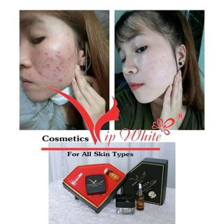 combo serum white skin Cream
