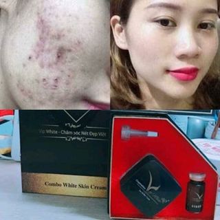 combo serum white skin Cream