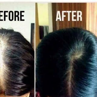 Dầu gội trị rụng tóc và phục hồi tóc