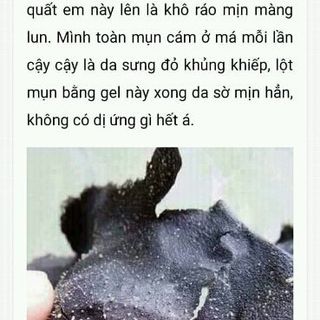 gel lột mụn than tre lê thanh lẽ 60k