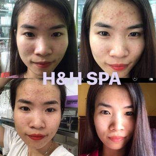 Bột rửa mặt thảo mộc HH spa