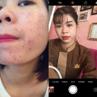 Bột rửa mặt thảo mộc HH spa