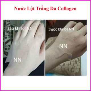 Lột Trắng Da Sinh Học