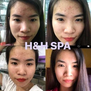 bột rửa mặt thảo mộc