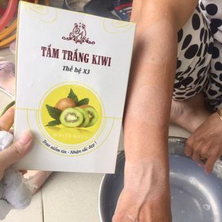 Tắm trắng KiWi