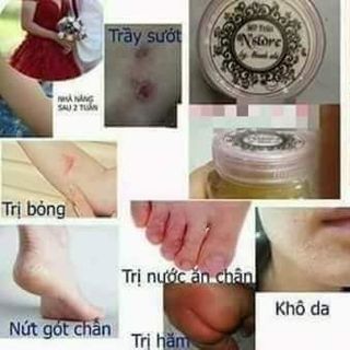 Mỡ trăn Nstore
