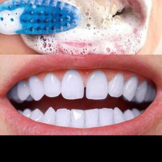 Kem Đánh Răng BAKING SODA TOOTHPASTE