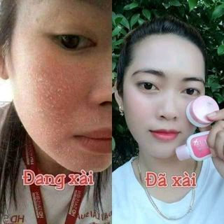 Combo Kem Konethái lan