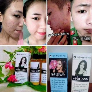 Rượu dưỡng da thảo mộc