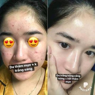 Combo Plankton cao cấp từ soHERBs