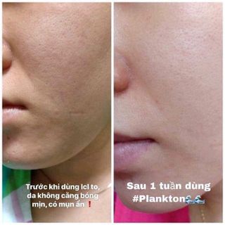 Combo Plankton cao cấp từ soHERBs