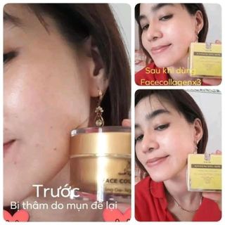 Kem Face Collagen X3 Trắng Da Căng Bóng