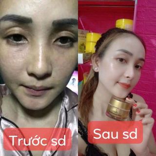 Kem Collagen X3 Giá Rẻ