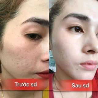Kem Collagen X3 Giá Rẻ
