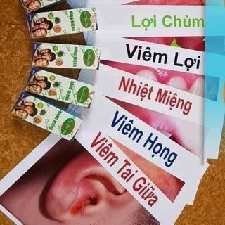 Tinh Dầu đặc trị viêm họng viêm Amidam giá sỉ