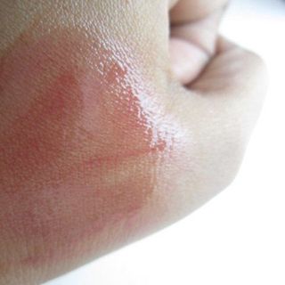 Sản Xuất Gia Công Peel AHA Peel BHA