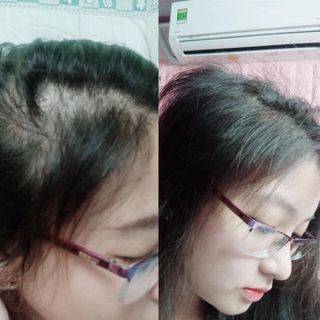 TINH DẦU BƯỞI - Kích thích mọc tóc