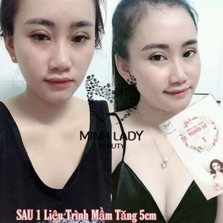 Mầm đậu nành minhlady beauty 100 thiên nhiên