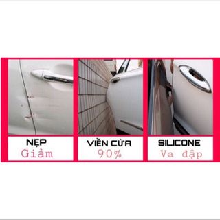 nẹp viền chống va