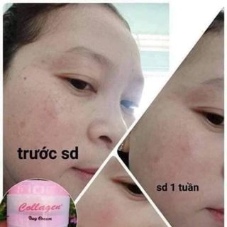 Combo Kem collagen e vit plus