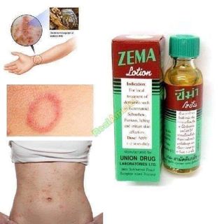 THUỐC ĐẶC TRỊ chàm lác ZEMA LOTION