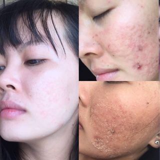 SERUM THÃO DƯỢC NGỌC LINH SÂM