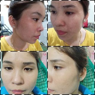 SERUM THÃO DƯỢC NGỌC LINH SÂM