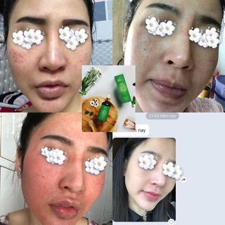 SERUM THÃO DƯỢC NGỌC LINH SÂM