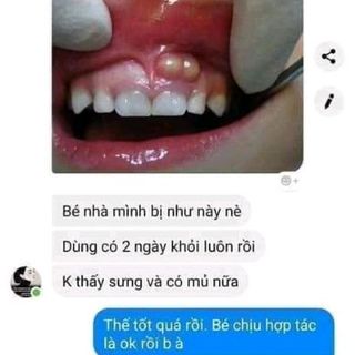 Dạ Thảo Liên Tinh Dầu Chuyên Trị Sâu Răng Viêm Họng giá sỉ