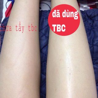 Tẩy Tế Bào Chết DIAMOND LADY