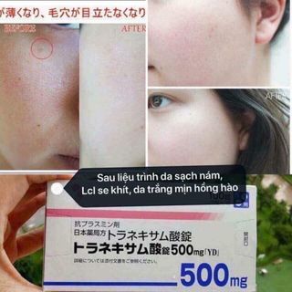 VIÊN UỐNG TRẮNG DA TRỊ NÁM 500mg