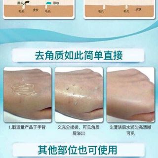 TẨY DA CHẾT GẠO