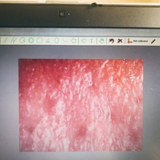 MÁY SOI DA MINI KẾT NỐI ĐTLAPTOP MÁY TÍNH BẢNG