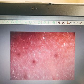 MÁY SOI DA MINI KẾT NỐI ĐTLAPTOP MÁY TÍNH BẢNG