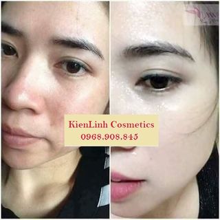 Set Kem Collagen Plus Vit E