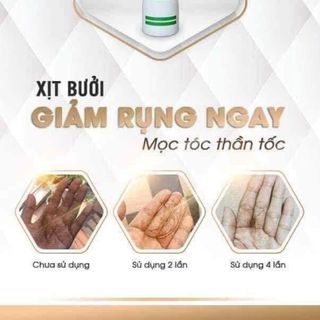 XỊT BƯỞI DƯỠNG TÓC-TRỊ RỤNG TÓC-TRỊ GÀU