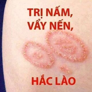 kem bôi da Thuần Mộc