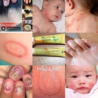 kem bôi da Thuần Mộc