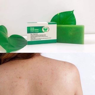 SOAP BODY ACNES-TRỊ MỤN LƯNG VIÊM NANG LÔNG