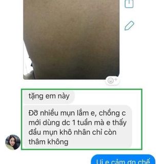 SOAP BODY ACNES-TRỊ MỤN LƯNG VIÊM NANG LÔNG
