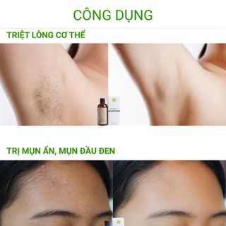 FREE SHIP Mỡ Trăn Giá Sỉ Cháy Hàng Liên Tục Không Lo Tồn Hàng Lợi Nhuận Cao